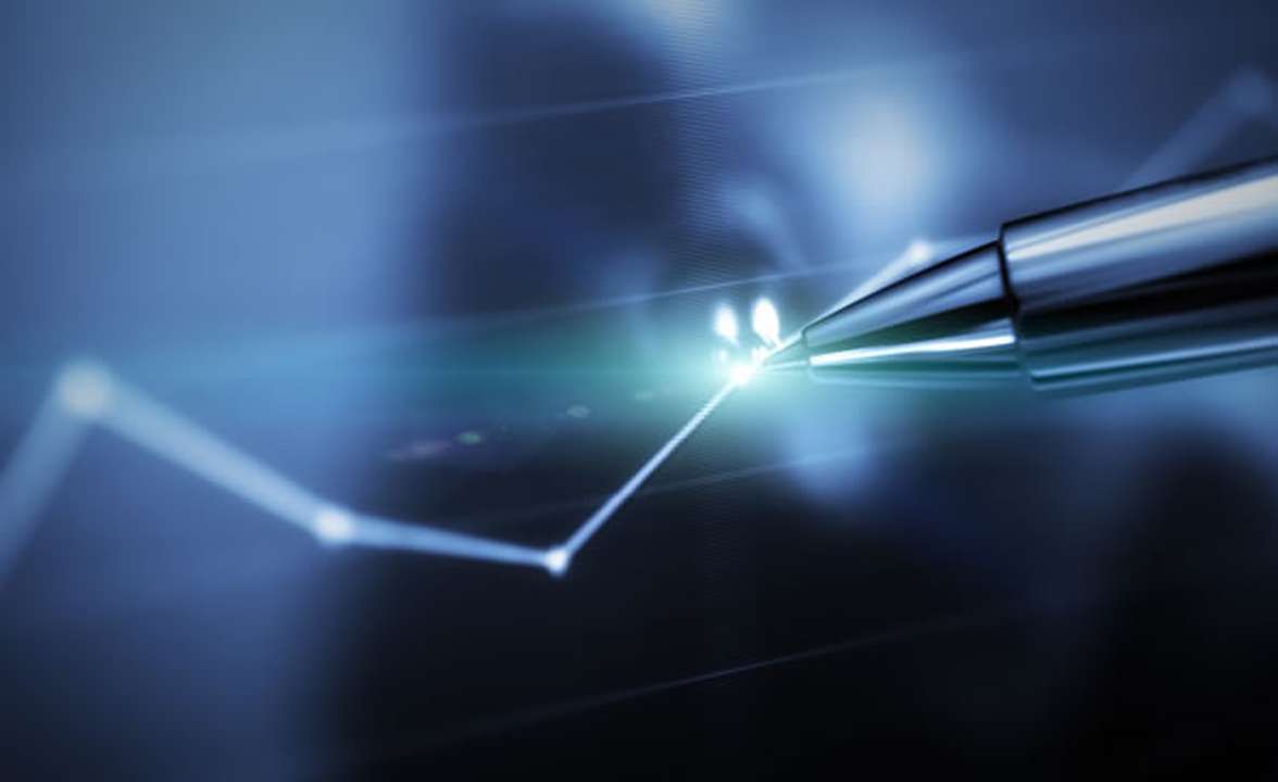 Why Pension Governance Matters Even When You've Joined a Master Trust Image